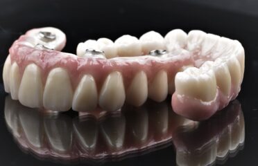Dental Implants on Miller