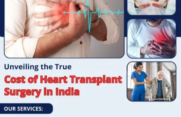 Best Package For Heart Transplant Surgery in India